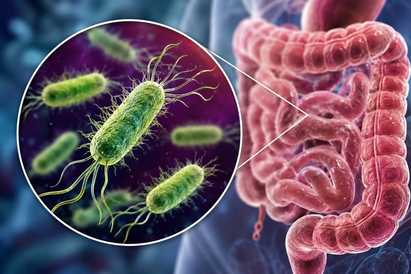 infezione da escherichia coli